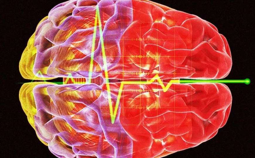 Naučnici snimili šta se dešava u mozgu čovjeka koji umire - rezultat je zapanjujući