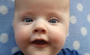 Budimo ljudi: Pomozimo 7-mjesečnom Adinu kako ne bi oslijepio