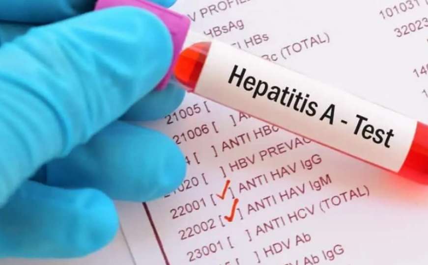 U regiji se pojavila epidemija hepatitisa A, uglavnom zaraženi srednjoškolci