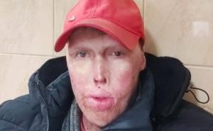 Aldin je pokrenuo val dobrote u Pomozi.ba: Danas on ponovo treba našu pomoć