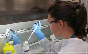 WHO: Treba uvesti mjere zbog majmunskih boginja