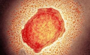 WHO: Moramo promijeniti ime majmunskim boginjama