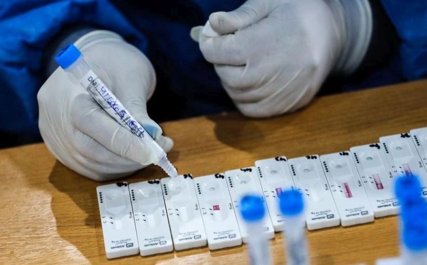 COVID izvještaj: Od jučer je preminulo 12 osoba od zaraze koronavirusom u Hrvatskoj