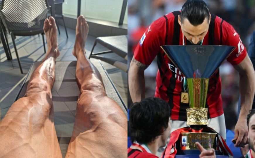 Nevjerovatan prizor: Noge Zlatana Ibrahimovića 11 mjeseci nakon operacije koljena