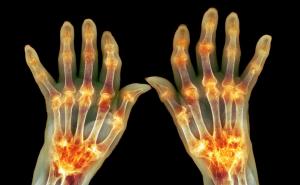 Možda štetite svojim kostima, a da to ni ne znate: Šta trebate izbjegavati?