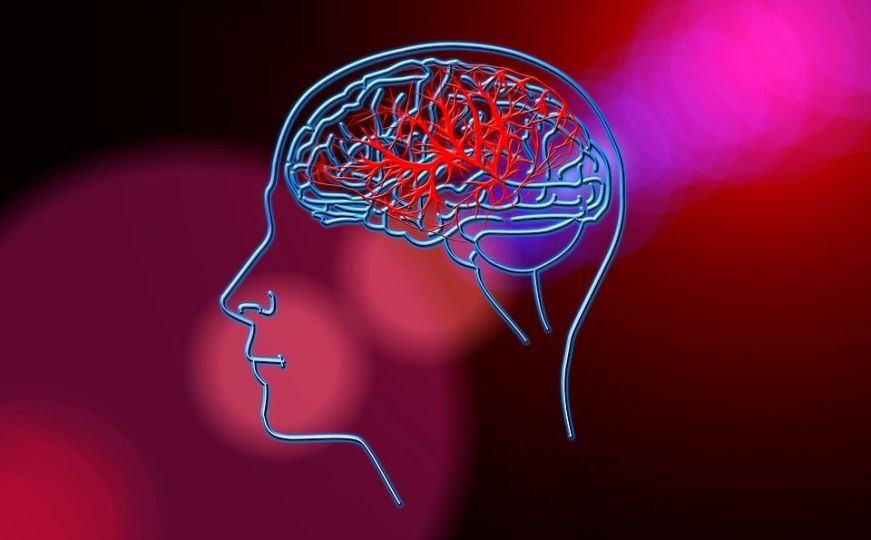 Naučite kako prepoznati simptome moždanog udara