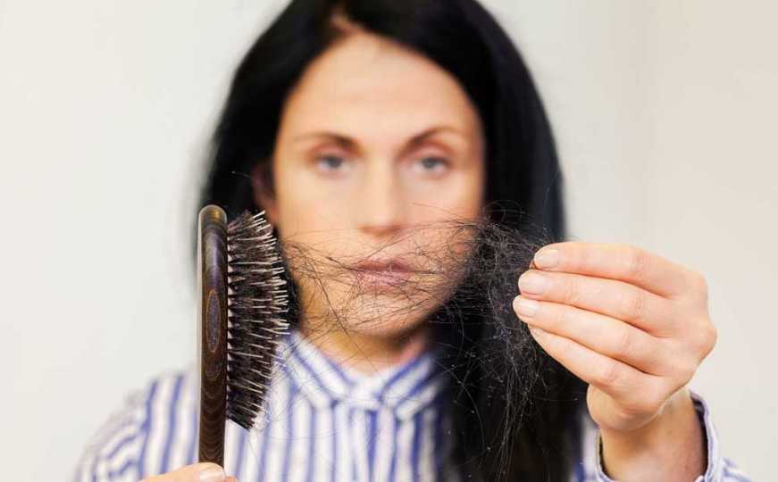 Sve što niste znali o alopeciji, opadanju kose na koje nisu imuni ni poznati
