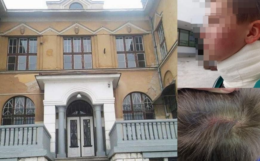 Horor u Sarajevu: 9-godišnjaka napala majka dječaka s kojim ide u razred. Zadobio teške povrede?