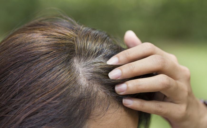 Napravite prirodni šampon za suho pranje kose: Trebaju vam samo dva sastojka