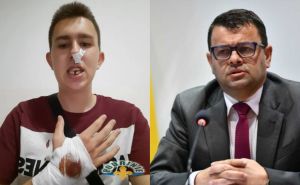 Hurtić o brutalnom napadu na mladića u Bratuncu: Tražim od policije da hitno uhapsi nasilnike!