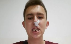 Osman Mehanović za Radiosarajevo.ba: 'Ovo nije prvi put da sam napadnut'