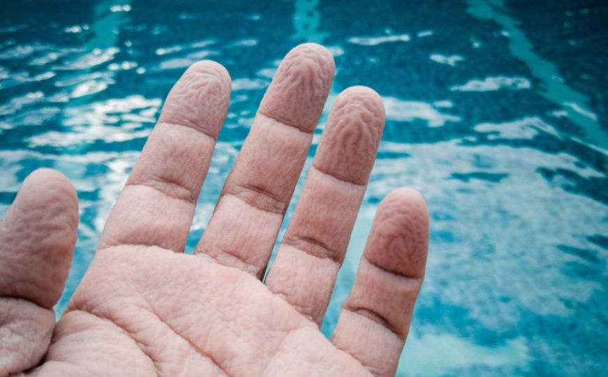 Sigurno vam se nekada dogodilo: Zašto su od vode smežurani prsti na rukama i nogama?
