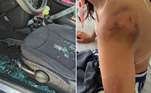 Žena objavila slike nastale nakon superćelijske oluje: Izubijana, posječena, sva u modricama