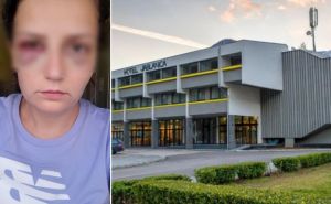 Pretučena radnica hotela 'Jablanica' za Radiosarajevo.ba: Brutalno me tukao po glavi, imam prelome