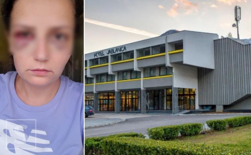 Potvrđeno: Radnica Enisa Klepo tužila vlasnika hotela Jablanica koji je teško pretukao