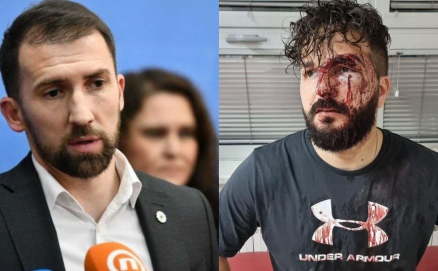 Adnan Delić o napadu na novinara: 'Moramo zajedno stati u odbranu onih čija prava se narušavaju'