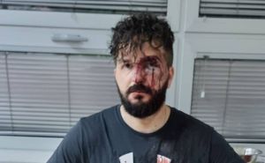 BH Novinari: 'Napad na Mirzu Derviševića dio sve učestalijeg nasilja prema nama'