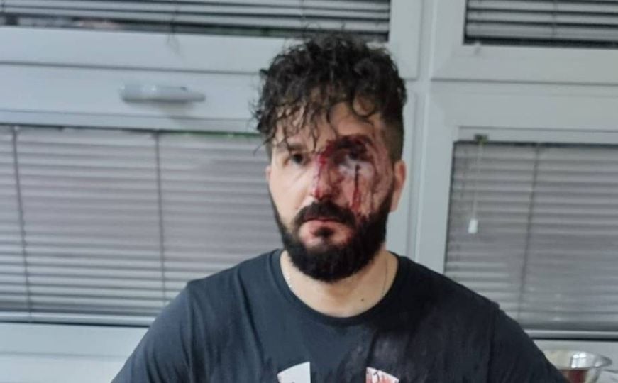 Više od dva sata davao izjavu policiji: Dervišević otkrio imena koja smatra odgovornim za napad
