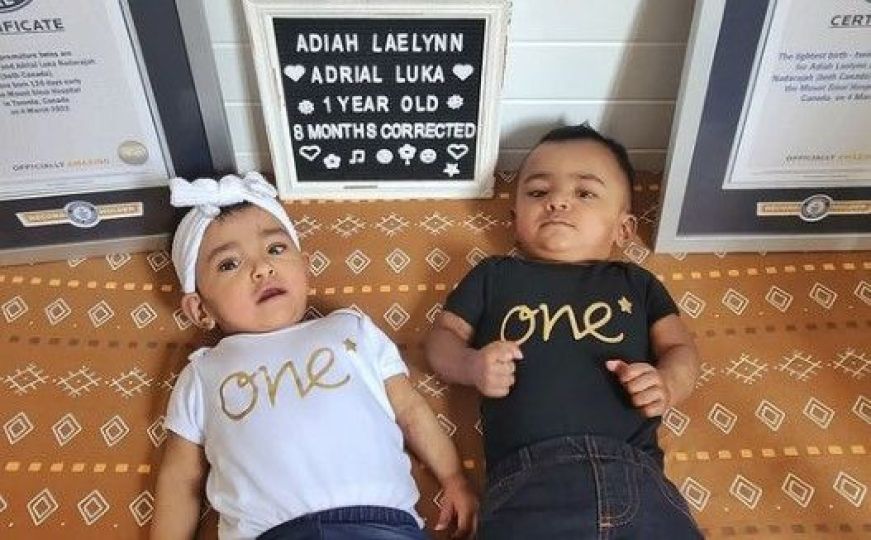 Uprkos nikakvoj šansi da prežive: Prerano rođeni blizanci nedavno proslavili svoj prvi rođendan