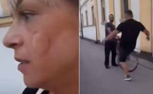 Muškarac u bh. susjedstvu napao ženu - ugrizao je za lice. Nije bio hrabar kada je naišao prolaznik