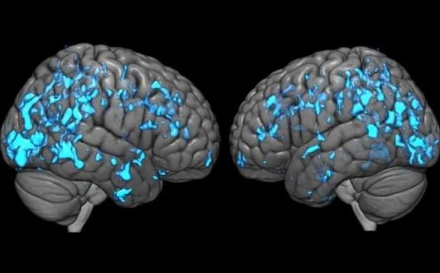 Naučnici objasnili: Šta se dešava sa vašim mozgom ako svaki dan kukate?