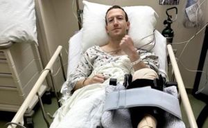 Mark Zuckerberg objavio fotografiju iz bolnice i pojasnio šta mu se dogodilo
