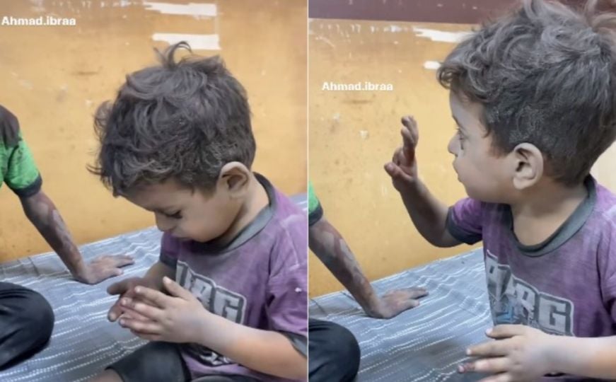 Snimak koji slama srce: Dječak u Gazi drhti od straha i pokazuje povrede nakon bombardovanja