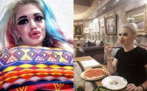 Djevojka sa najvećim usnama na svijetu: 'Doktori kažu da sam pretjerala'