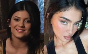 Kylie Jenner objasnila kako je promijenila izgled: 'Nisam se operisala'