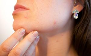 Šest načina da ublažite simptome atopijskog dermatitisa