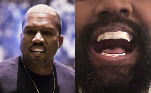 Kanye West izvadio sve zube i zamijenio ih protezom koja je skuplja od dijamanata
