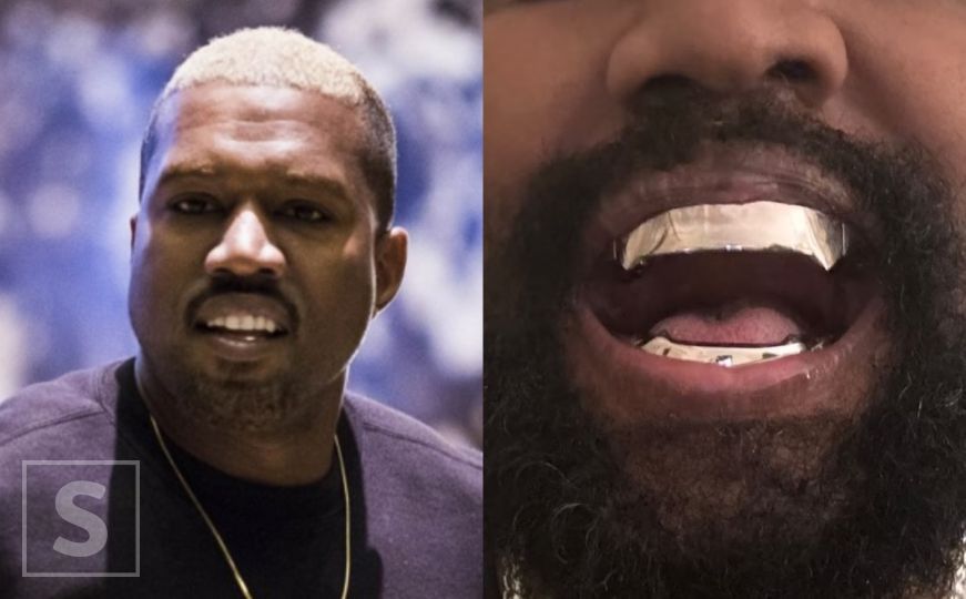 Kanye West izvadio sve zube i zamijenio ih protezom koja je skuplja od dijamanata