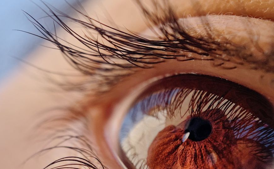 Ljudi zgroženi saznanjem šta izlazi iz našeg oka: Evo šta su 'krmelje' koje imamo nakon spavanja