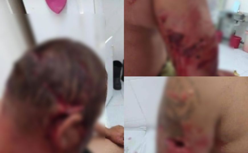Horor u BiH: Migrante napao medvjed, zadobili teške tjelesne povrede