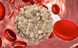 Njemačka postala europski lider u inovacijama za borbu protiv raka: Evo ko je broj jedan u svijetu