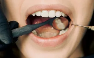 Prva pomoć kod zubobolje i lošeg zadaha: Ovaj začin čini čuda