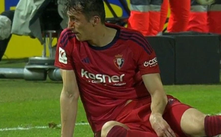Horor u Španiji: Hrvatski nogometaš krvave glave pao na teren, pa izgubio svijest