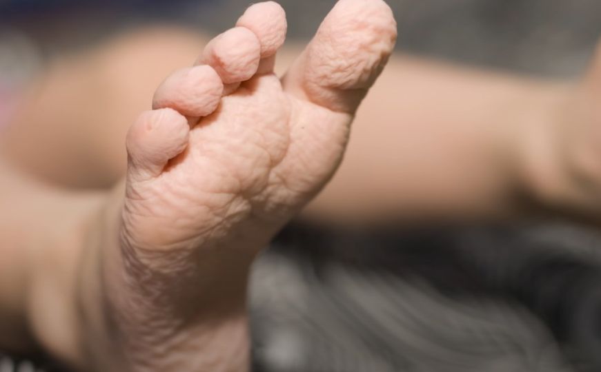 Naučnici otkrivaju tajnu smežuranja prstiju: Evo zašto se koža promijeni pri dodiru s vodom