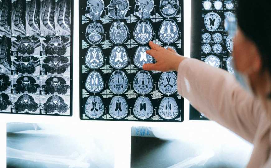 Ugledni neurolog otkriva: Ove četiri stvari izbjegavam, uništavaju mozak i pamćenje