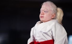 Ispovijest hrabre albino djevojčice: 'Moj jedini cilj je biti prvak Evrope u karateu'