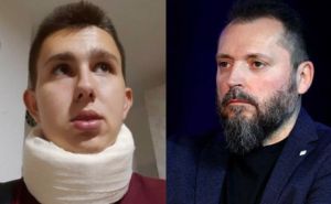 Bursać: Hoće li napadnuti Osman Mehanović sudski odgovarati što je pretučen?