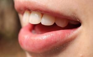 Stomatolog otkriva: Suha usta mogu ukazivati na mnogo ozbiljnije probleme nego što ste svjesni