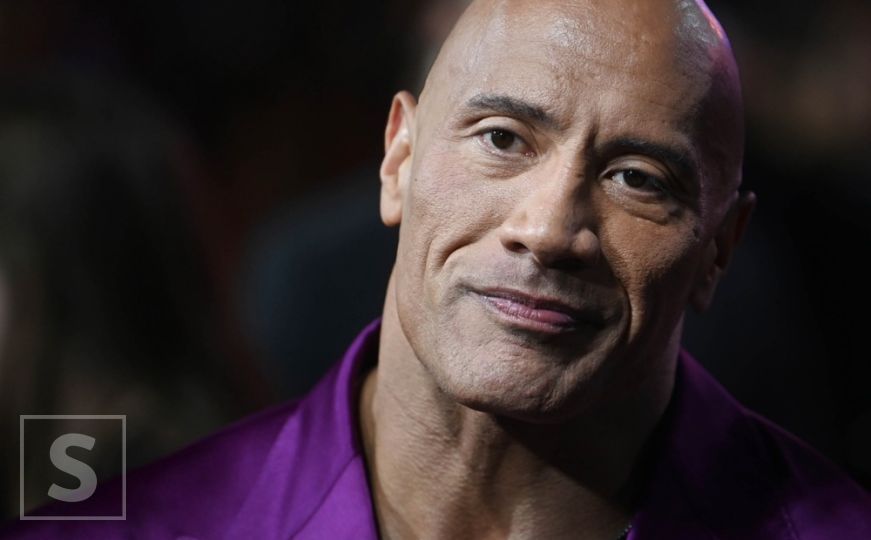 Dwayne Johnson pokazao gadnu povredu koju je zadobio tokom snimanja filma