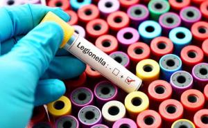 Ugledni infektolog o legioneli: Kako se širi, koji su simptomi i ima li razloga za brigu