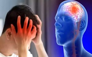 Doktor upozorava: Ovo su faktori rizika za moždani udar