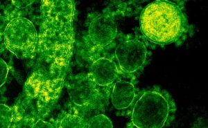 Naučnici u panici: Novi soj opasne bakterije zahvatio 16 zemalja, simptomi su zastrašujući