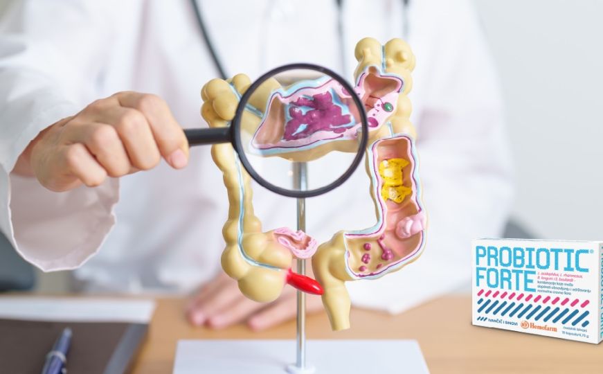 Savjeti iz Hemofarma: Najčešće postavljena pitanja o antibioticima i probioticima