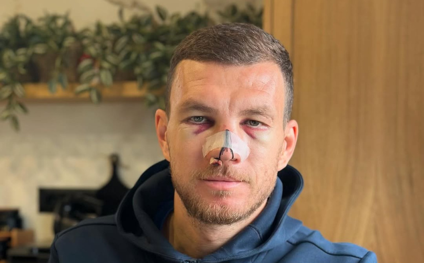 Brojne reakcije na fotografiju ratnika Džeke: Javili se Balotelli, Nainggolan, Grafite...