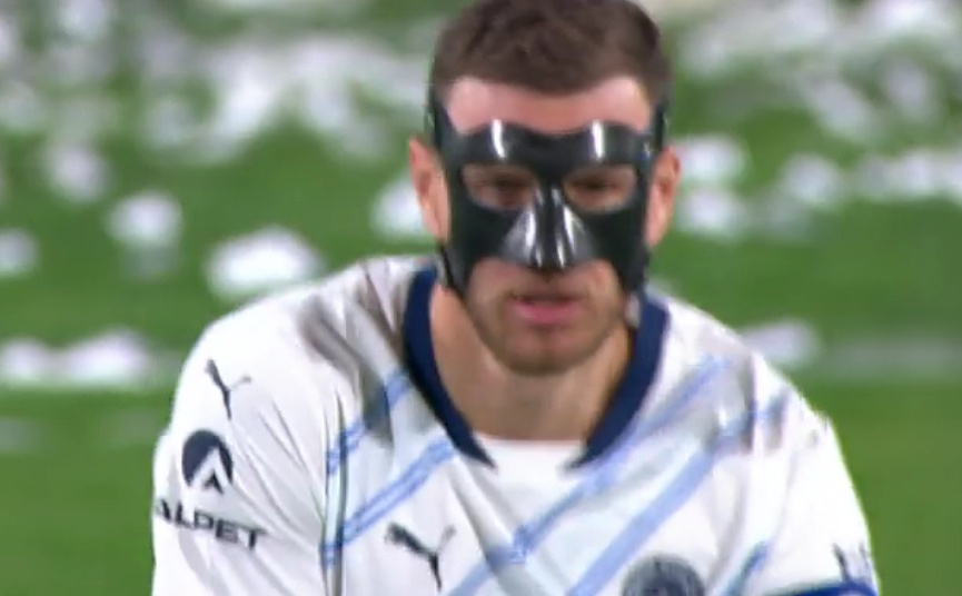 Edin Džeko zaigrao sa zaštitnom maskom: Fenerbahce slavio pobjedu