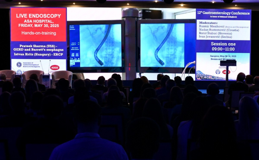 ASA Bolnica domaćin međunarodnog Live Endoscopy workshopa u okviru 12.Gastroenterološke konferencije